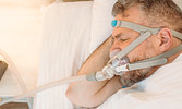 Sleep Apnea